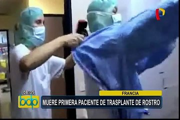Francia: muere primera paciente de trasplante de rostro