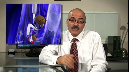 What is an Implant by Katelaris Urology