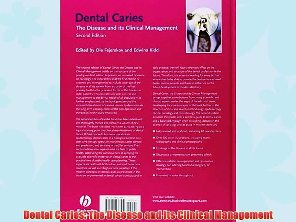 [PDF] Dental Caries: The Disease and Its Clinical Management Popular Colection