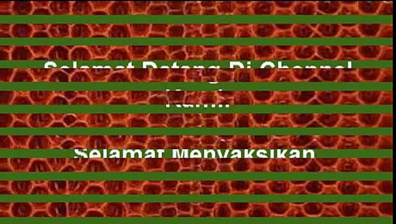 Tanya Jawab - Ada Wanita Tidak Pakai Jilbab, Apakah Ibadahnya Diterima؟ Ustadz Dr Khalid Basalamah