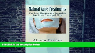 Big Deals  Natural Acne Treatments: The Best Homemade Remedies For Acne Damaged Skin  Best Seller