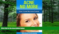 Big Deals  Acne: How I Cured My Acne Forever: Ex-Sufferer Discovers Powerful Secret To Acne Free