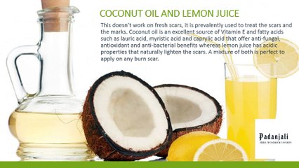 Home Remedies For Burns And Scars | Padanjaly