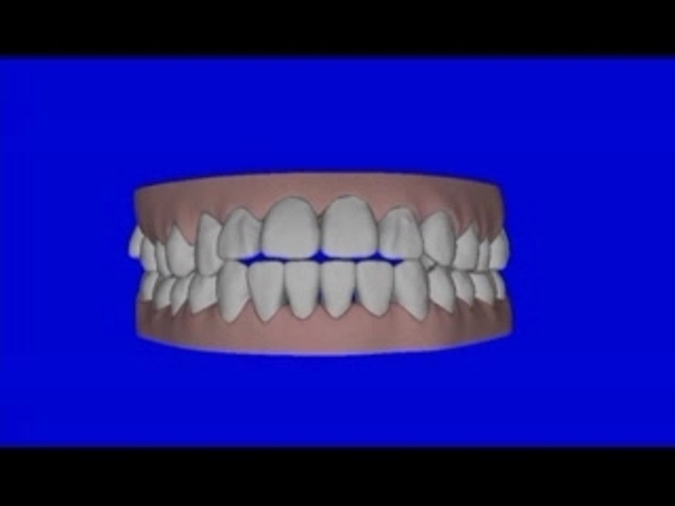 Orthodontie alignement des dents