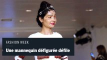 Un mannequin défiguré à l'acide en vedette à la Fashion Week de New York