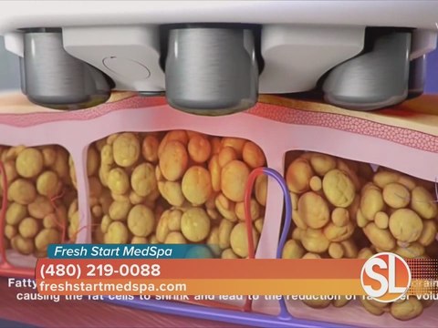 Fresh Start becomes first MedSpa in U.S. to offer Fusion Contouring