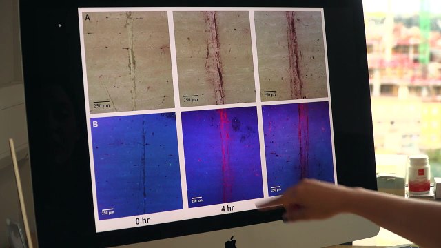 Nueva técnica permite obtener imágenes 3D de los huesos sin rayos X