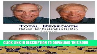 Collection Book Total Regrowth: Natural Hair Restoration for Men