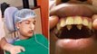 Teenager Is Recovering After Surgeons Removed 232 Extra Teeth From His Mouth