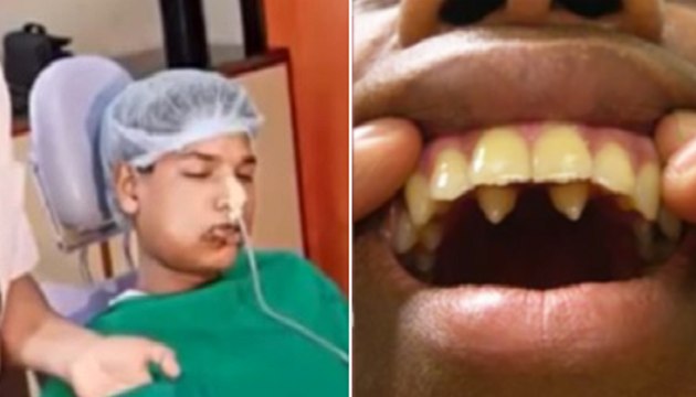 Teenager Is Recovering After Surgeons Removed 232 Extra Teeth From His Mouth