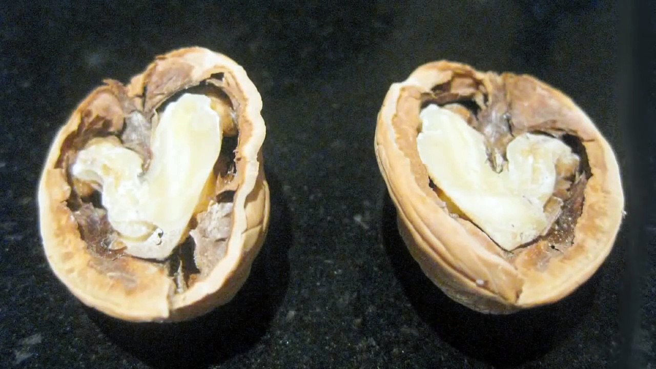 Walnuts and Artery Function