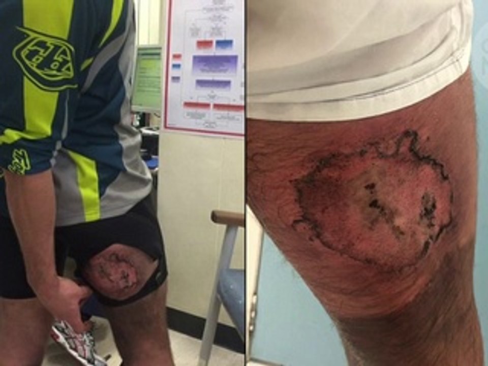 Ce biker chute à vélo et son iPhone prend feu sur lui !