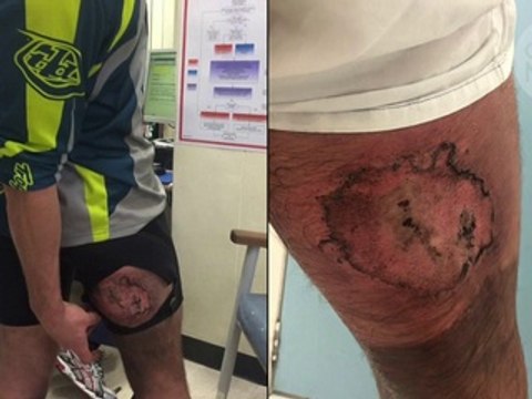 Ce biker chute à vélo et son iPhone prend feu sur lui !