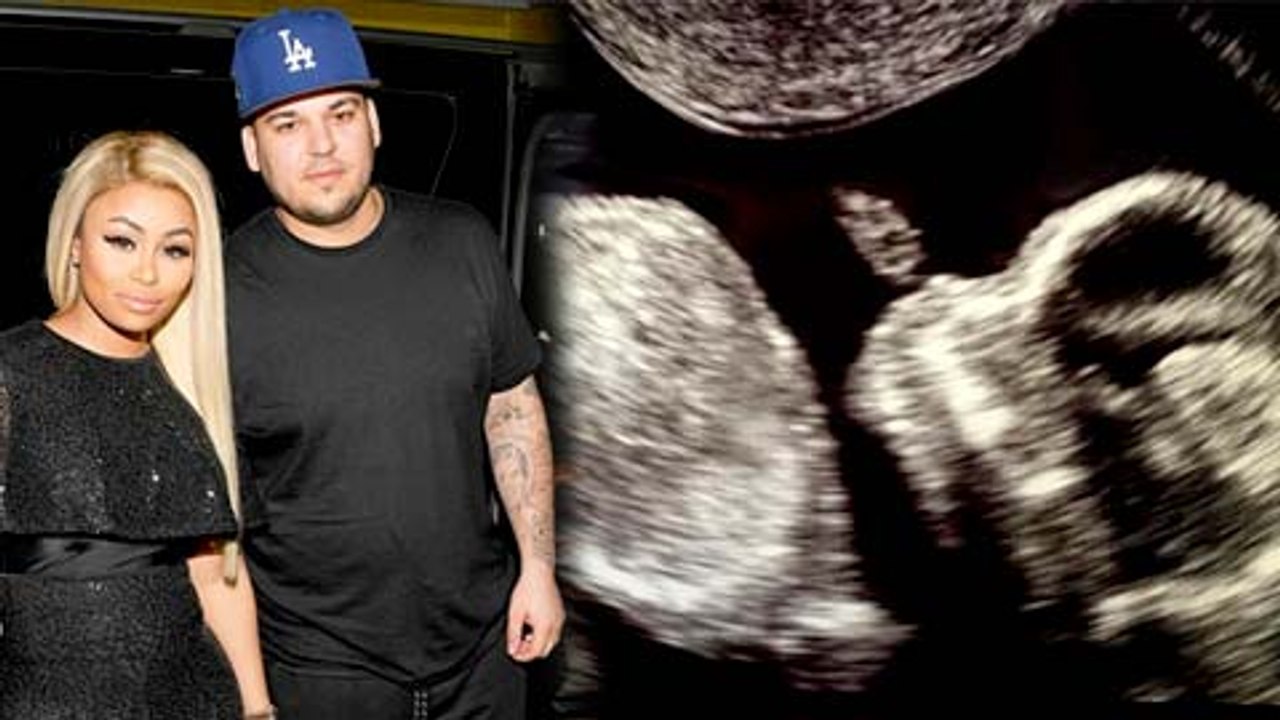 Blac Chyna & Rob Kardashian REVEAL Sex Of Baby