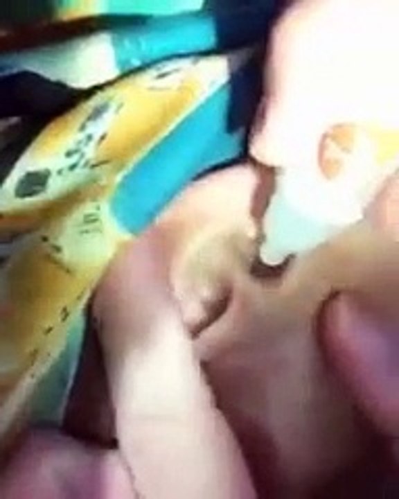 OMG!!! Worm stuck inside Ear