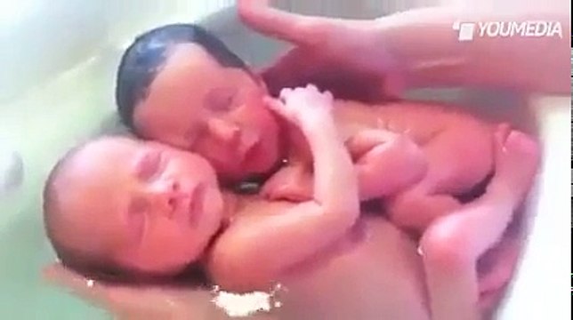 Il Video che ha fatto commuovere tutto il mondo - GEMELLINI APPENA NATI SI ABBRACCIANO