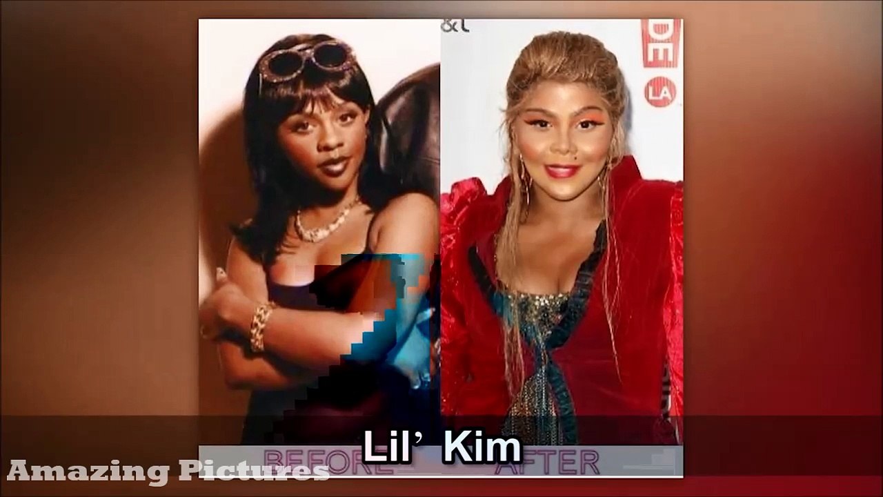 23 Worst Celeb Plastic Surgeries Ever