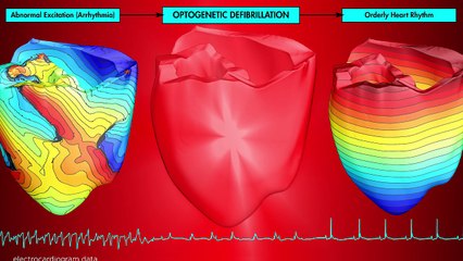 ¿Luz Roja para Salvar Vidas? La Innovadora Técnica de Defibrilación Óptica ⚡