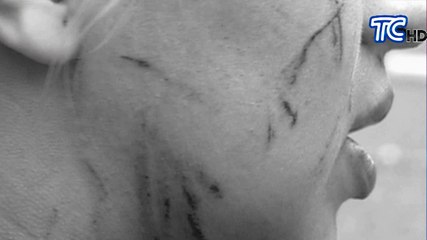 Mujer denuncia una agresión de la que fue víctima al suroeste de Guayaquil