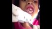Dentist Pulls Maggots Out of Little Girl Mouth