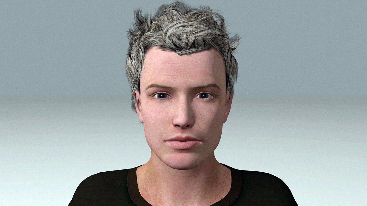 La maladie d'Alzheimer
