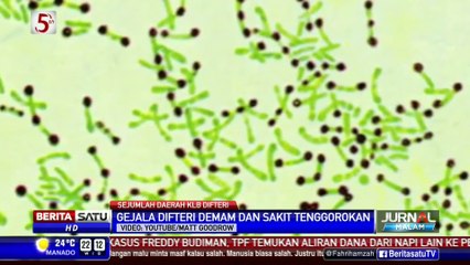 Mengenal Penyakit Difteri