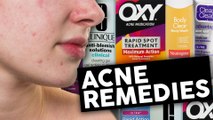 Top 4 Acne Treatments That Actually Work