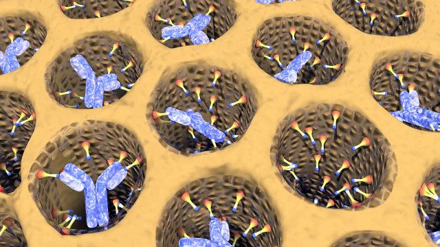 Why Do Plant-Based Diets Help Rheumatoid Arthritis?