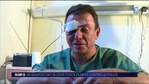 Loi Travail : un manifestant perd son oeil et porte plainte