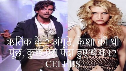 ऋतिक के 2 अंगूठे, केशा की थी पूंछ, कुछ ऐसे पैदा हुए थे ये 12 CELEBS by Bollywood Khabre