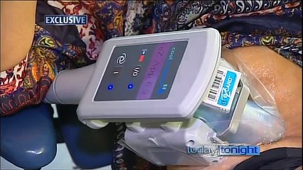 Cool Sculpting - Fat & Cellulite reduction