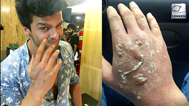 Kushal Tandon BURNT On 'Beyhadh' Set | Jennifer Winget | Aneri Vajani