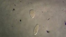Diplostomum