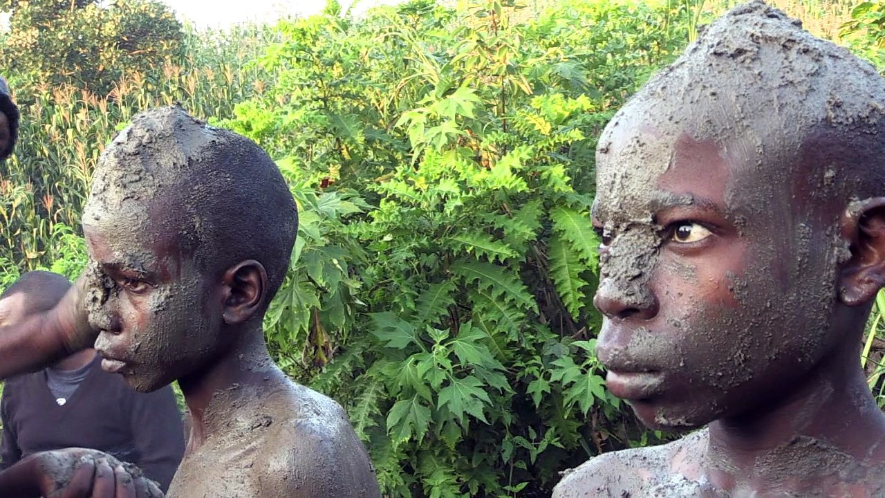 Kampf gegen HIV: Kenia setzt auf Beschneidungen