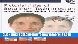 [PDF] Pictorial Atlas of Botulinum Toxin Injection: Dosage, Localization, Application Popular