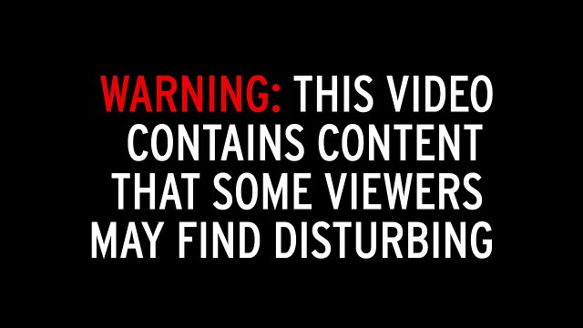 Quá trình phẫu thuật giun ngo ngoe trong mắt