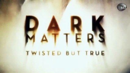 Mô phỏng lại quá trình ghép đầu khỉ vào năm 1970