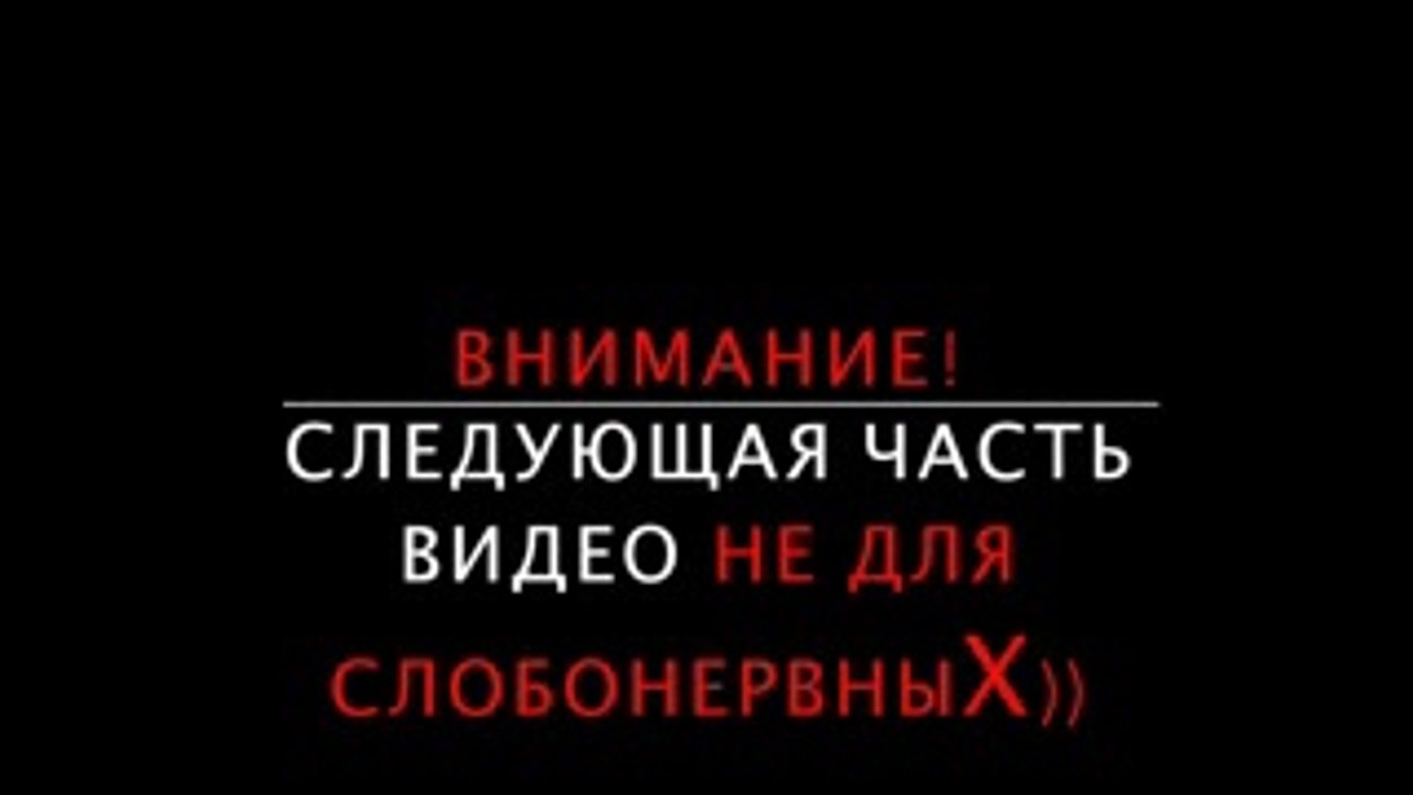 Настя Лисова после ринопластики носа (20.09.2016)