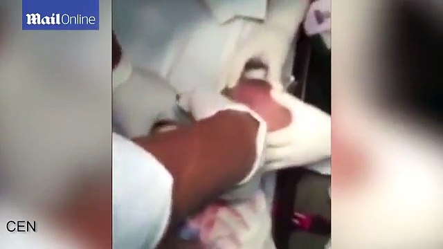 Cận cảnh lấy dị vật từ họng em bé