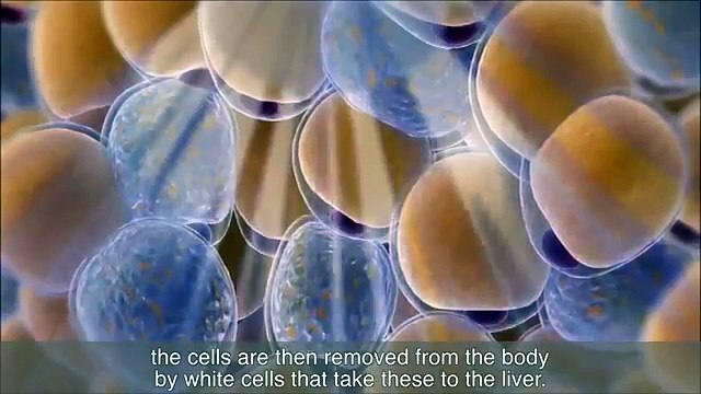 CoolSculpting Cryolipolysis (Fat Freeze) Technology Explained (1)