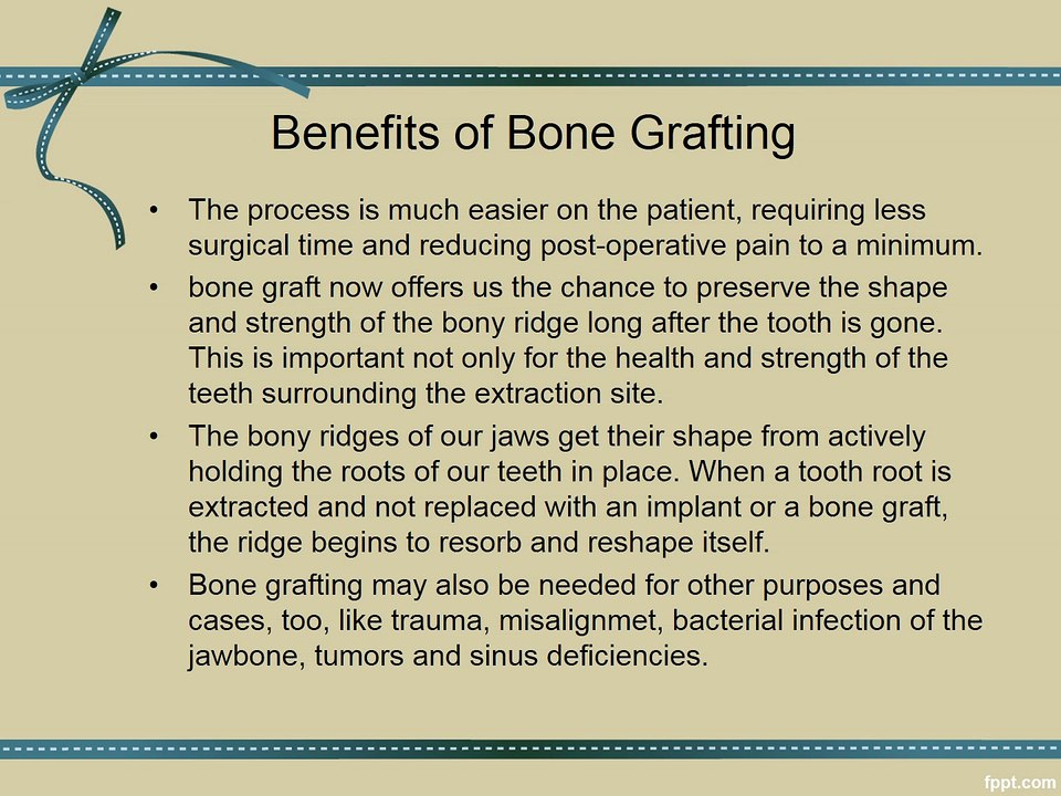 Bone Graft for Dental Implants