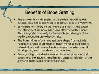 Bone Graft for Dental Implants