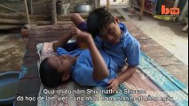 Clip trẻ em - Cặp đôi song sinh dính liền nhau ở Ấn Độ