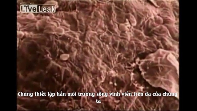 Ghê rợn loài sinh vật kí sinh trên da người nhiều hơn số dân trên Trái Đất