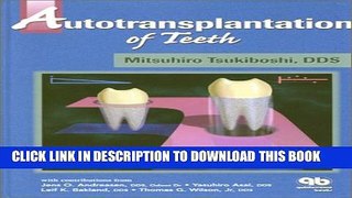 New Book Autotransplantation of Teeth