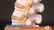 Barrow Brain and Spine (Chandler) discusses optimal spine health