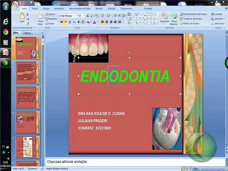 Gravação ENDODONTIA 01-SD