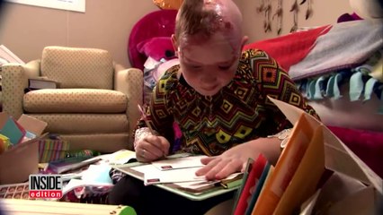 Rapariga Com 11 Anos Perde Couro Cabeludo A Andar Em Carrossel!