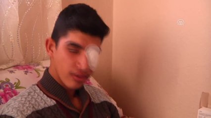 Çocukların Oyun İçin Attığı 'Torpil' Gözünden Etti