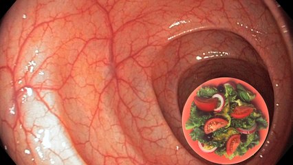 Relieving yourself of excess estrogen